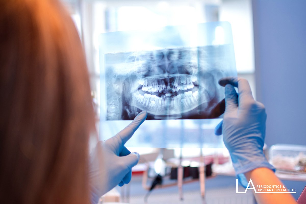 3D CBCT dental imaging scanner used for treatment planning at LA Periodontics
