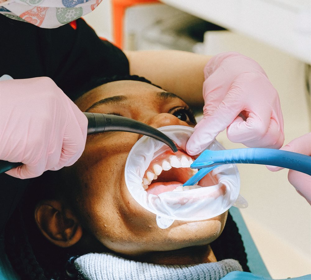 Los Angeles periodontist consulting with a patient about gum recession and gum graft options