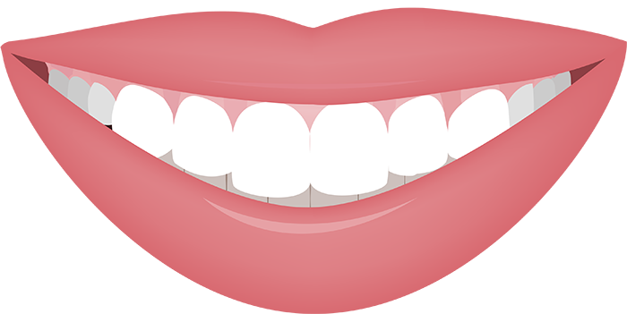 Close-up of a smile before and after cosmetic gum recontouring for a gummy smile