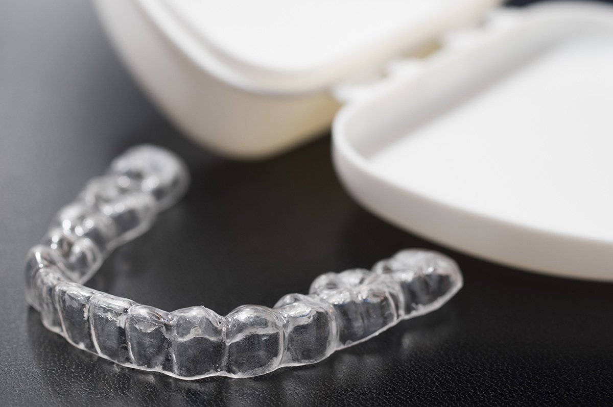 Custom occlusal night guard for teeth grinding, LA Periodontics Los Angeles