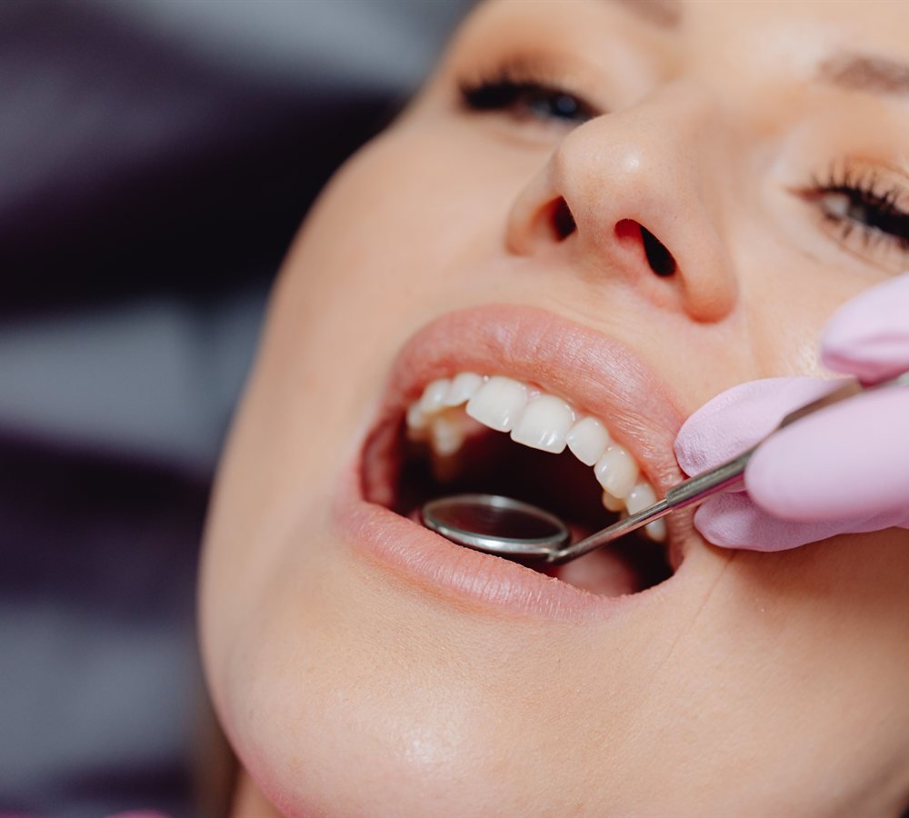 Close-up of a routine intraoral cancer screening exam